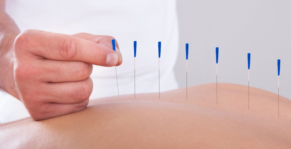 Complementary and Alternative Medicines for Chronic Pain