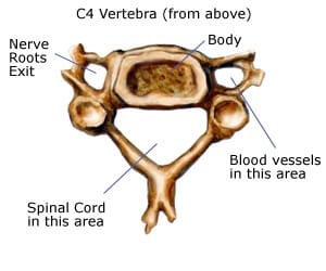 sciatica cause