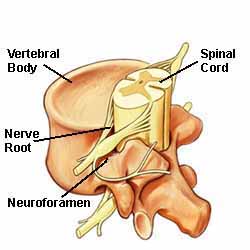 sciatica cause