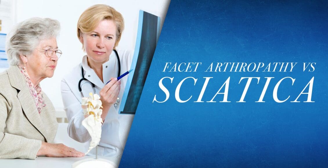 Facet Arthorpathy vs Sciatica | El Paso, TX Chiropractor