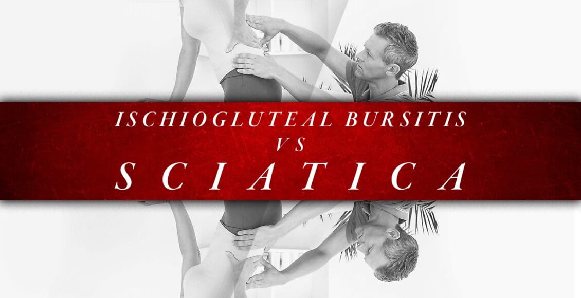 Ischiogluteal Bursitis vs Sciatica | El Paso, TX Chiropractor