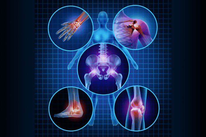 Ultrasound-Guided Orthobiologics for Joint Health Benefits