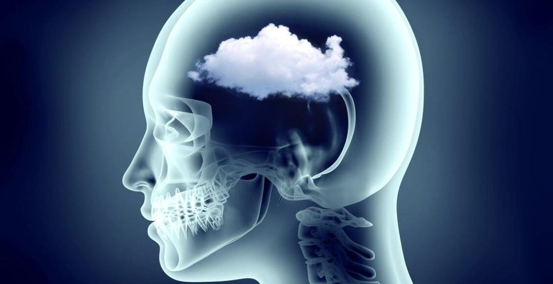 Functional Neurology: Understanding Brain Fog and Head Pain | El Paso, TX Chiropractor