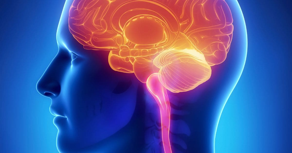 Causes and Diagnosis of Fibromyalgia | Southwest Chiropractor