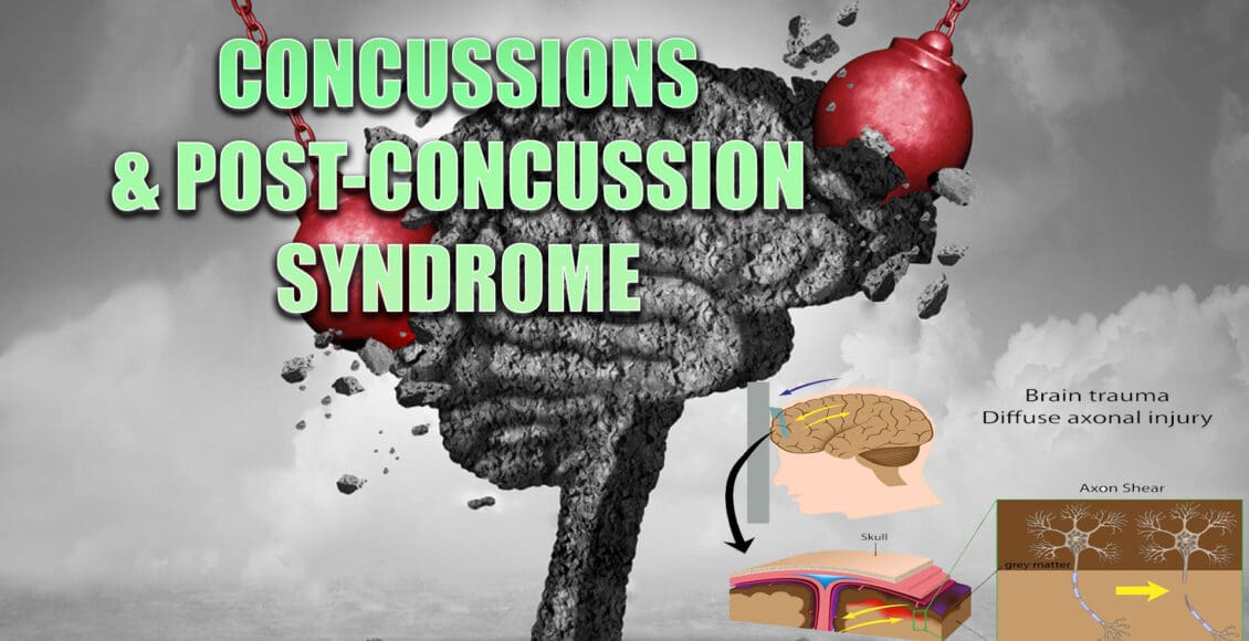 concussions el paso tx.