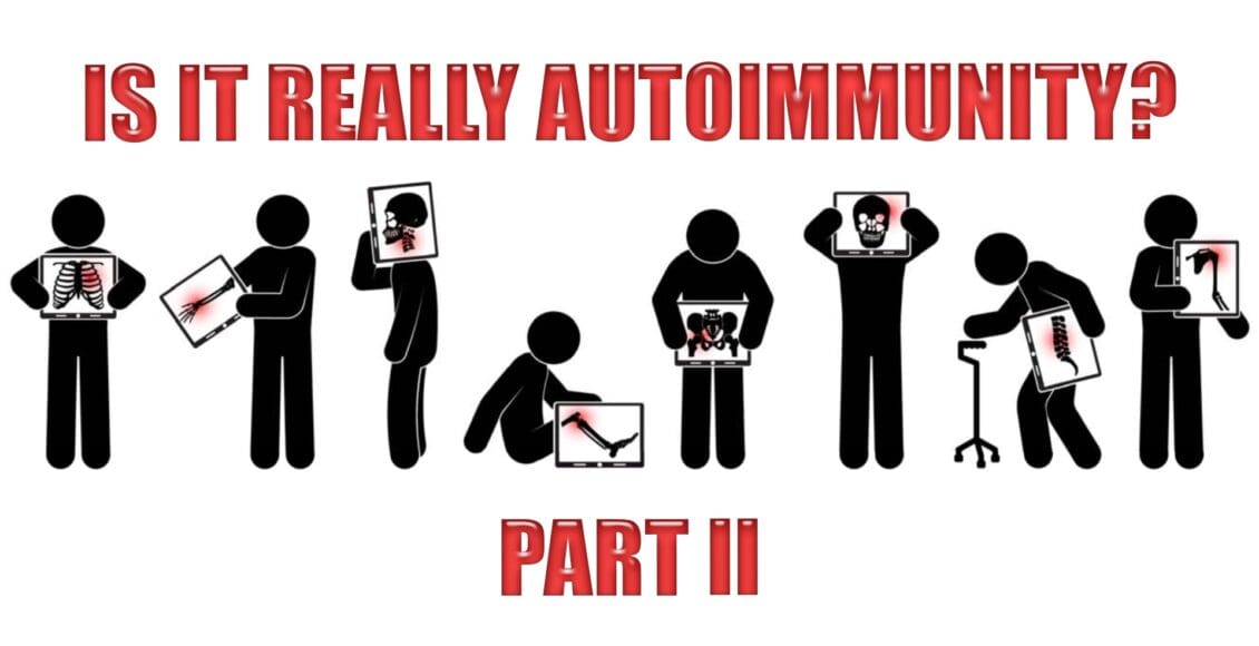 autoimmunity el paso tx.