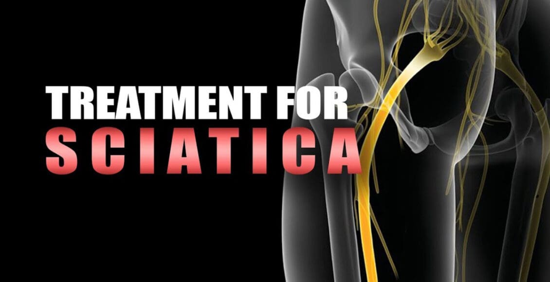 sciatica nerve pain el paso, tx