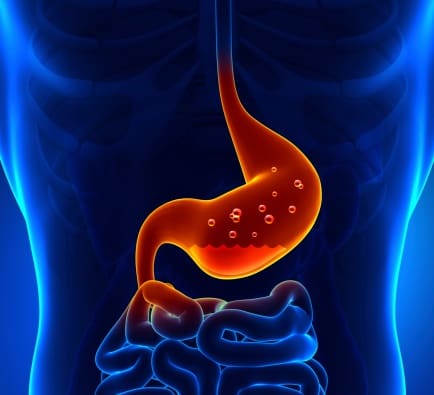excessive-stomach-acid